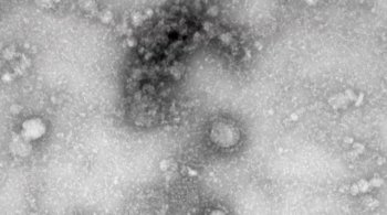 Коронавирус 