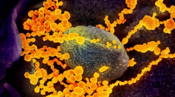 изображение электронного микроскопа показывает SARS-CoV-2 